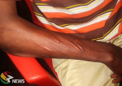 Ankaful hospital investigates staff brutality on 63-year-old patient 5