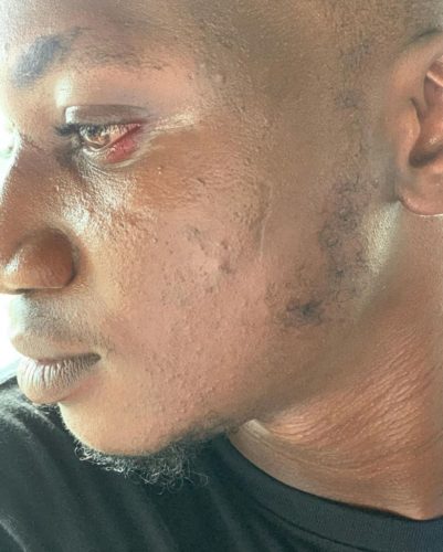 Peruzzi apologises to Pamilerin for assaulting him 14