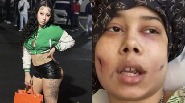 [WATCH] Houston Rapper SkyTheFinest Trolls Assailants After Being Shot In The Face 12