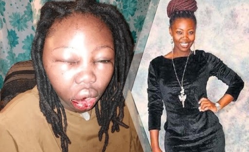 Actress beaten beyond recognition by her boyfriend for kissing in a movie 40
