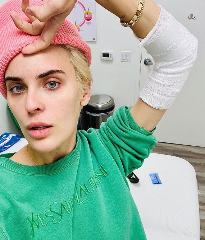 Tallulah Willis Shares Behind-the-Scenes Look at Tattoo Removal Process: ‘It Really Does Work’ / WATCH VIDEO 17