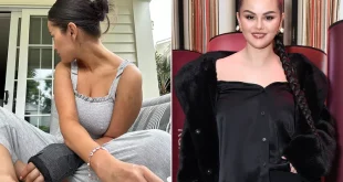 Selena Gomez Posts New Photos of Broken Hand in Cast After Revealing She Tripped in Summer Dress
