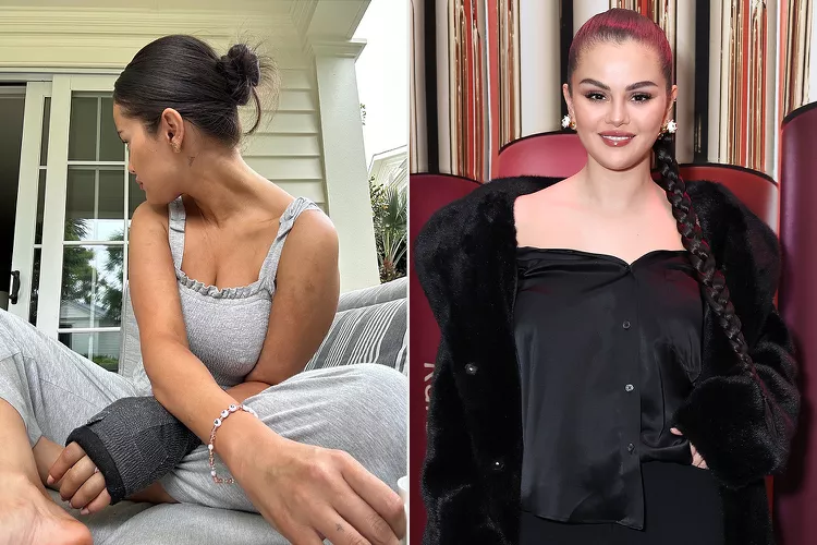 Selena Gomez Posts New Photos of Broken Hand in Cast After Revealing She Tripped in Summer Dress 8